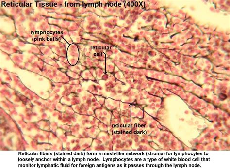 Reticular Tissue Under Microscope