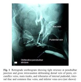 Retrograde urethrogram or a venogram? Be careful next time - Document - Gale Academic OneFile