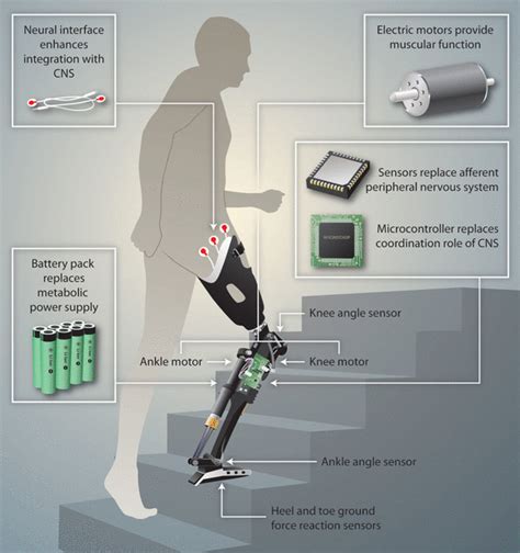 Realizing the Promise of Robotic Leg Prostheses | Science Translational Medicine