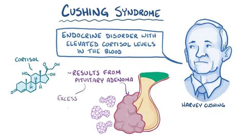 Cushing Syndrome Causes