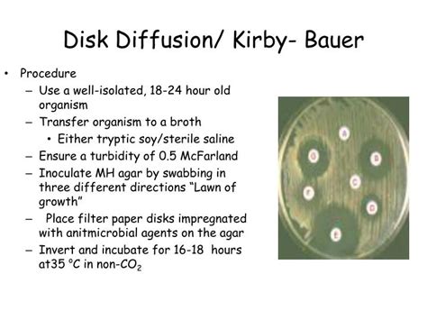 Kirby Bauer Disk Diffusion Method