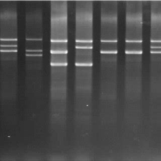 Multiplex-Gap PCR genotype analysis of the α -globin gene cluster on ...