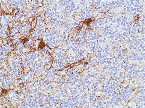 Brain Injury IHC Marker Antibody Duo (GFAP, MMP9) (ARG30292) - arigo ...