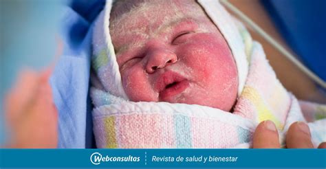 Vernix Caseosa Baby