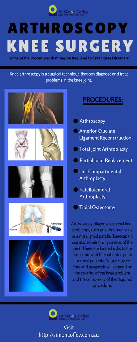 Arthroscopy Knee Surgery. #Kneearthroscopy #Arthroscopy #arthroscopyknee #kneesurgery | Knee ...