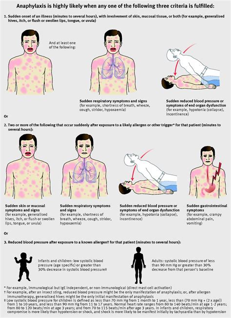 Anaphylaxis Treatment / Difference Between Anaphylaxis and Anaphylactic Shock ... - During an ...