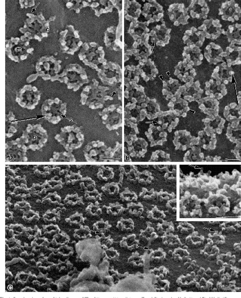 Figure 3 from The nuclear pore complex: three-dimensional surface structure revealed by field ...