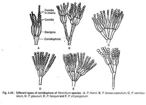 Different Types of Conidiophore of Penicillium Species | Biology notes, Medical laboratory ...