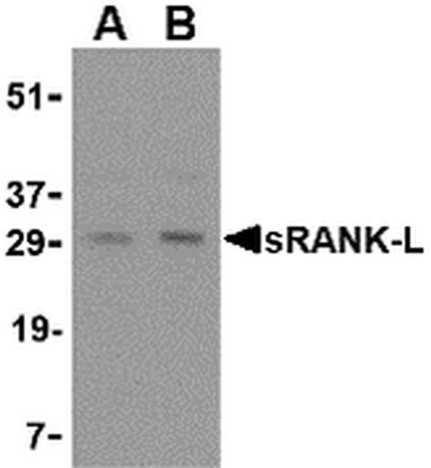 CD254 (RANK Ligand) Polyclonal Antibody (PA5-20291)