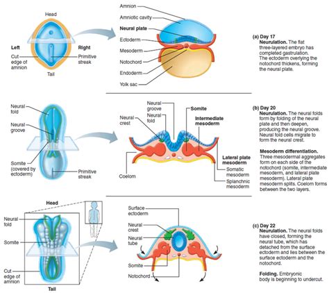 Spina Bifida - Causes, Symptoms, Types, Life Expectancy, Treatment