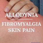 Allodynia: Fibromyalgia Skin Pain