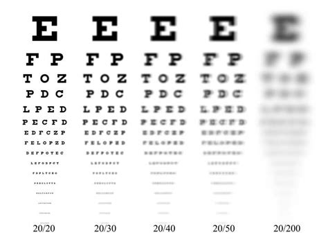 Stock Eye: Eye Exams — Illustrated Verdict