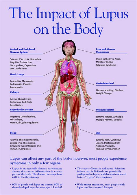 Fibromyalgia Flare Up Symptoms / The symptoms of a fibromyalgia flare often differ from the ...