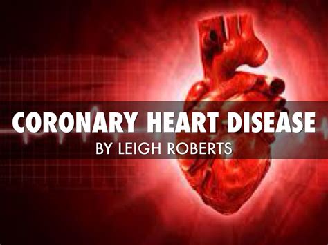 Coronary Heart Disease by Leigh Roberts