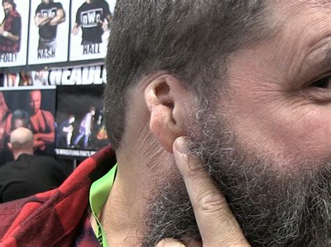 Mick Foley Shows Off Ear That Vader Famously Ripped Off, Still Not ...