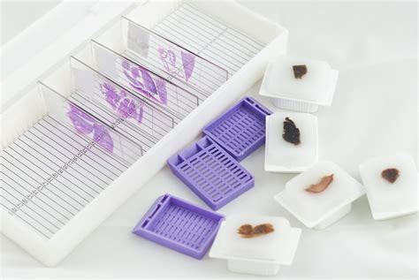 ᐉ FFPE Tissue Samples for Research | Purchase FFPE Blocks ᐉ Human FFPE Tissue