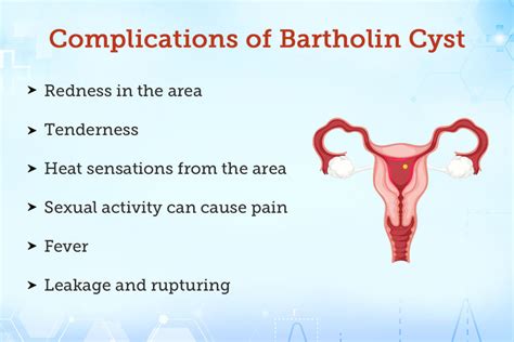 Bartholin S Cyst And Abscess Causes Symptoms Treatment | Hot Sex Picture