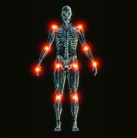 Arthritis 101: Joints Move Pain-Free with Physical Therapy