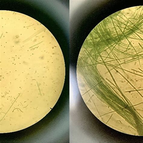 Algae in waterwater under microscope at 100 × | Download Scientific Diagram