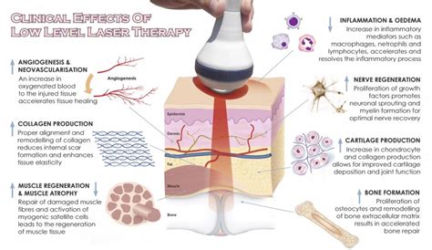 Laser Rejuvenation Treatment | Skin Tightening Laser Treatment