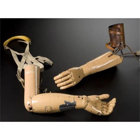 Upper Limb Prosthesis at Rs 25000 | Artificial Limbs in Secunderabad ...