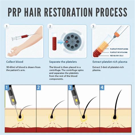 PRP For Hair Loss | Platelet-Rich Plasma at Revitalize Maui