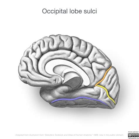 Image | Radiopaedia.org