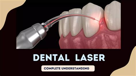 Dental laser: Types, parameter, Indication, advantage and dental laser precaution