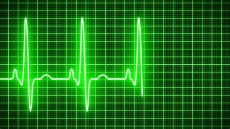 Animation of an Electrocardiography (ecg) Stock Footage Video (100% Royalty-free) 28831363 ...