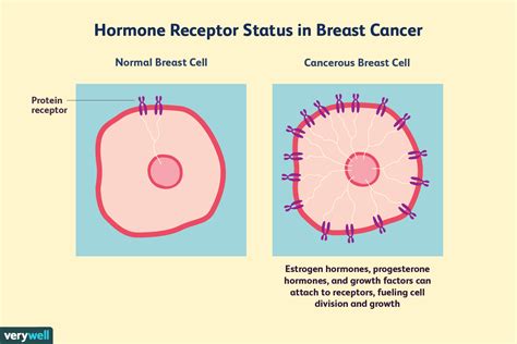 Hormone Receptor Status and Diagnosis in Breast Cancer