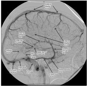 The major superficial and deep venous drainage of the brain on venous phase angiography ...