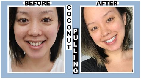 prílet výstava vzorka coconut oil pulling before and after diplomacia T ...