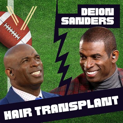 Deion Sanders' Hair Transplant: Before and After Transformation