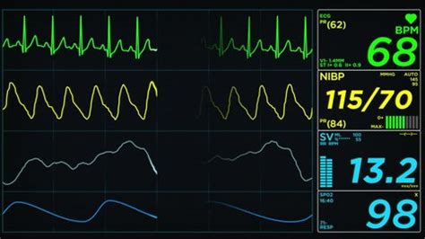 Medical Monitor Screen On Normal Heart Stock Footage Video (100% ...