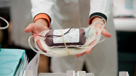 Exchange Transfusion: Purpose, Procedure, and Preparation