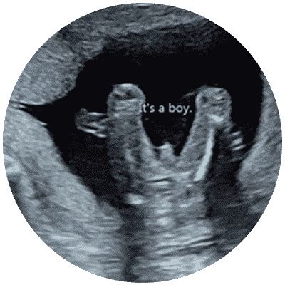 Gender Reveal Scan (99.9% Accurate) - Window to the Womb