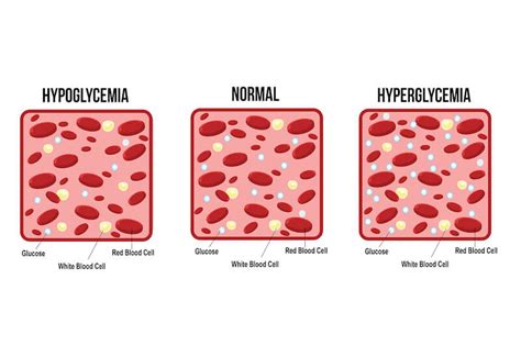 Hyperglycemia vs. Hypoglycemia: What's The Difference?