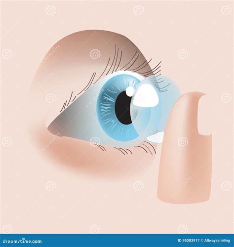 Realistic Style Vector Illustration with Eye and Contact Lens Stock Vector - Illustration of ...