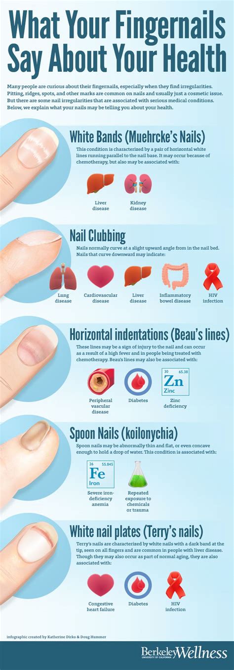 Health Archives - Page 2 of 30 | Fingernail health, An eye and Hiv aids