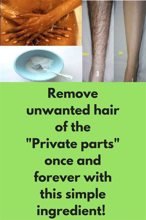 162 best Hair Removal images on Pinterest | Beauty tips, Beauty hacks ...