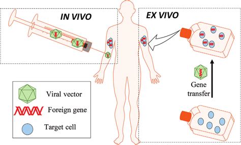 Diagram of in vivo and ex vivo gene therapy. In vivo gene therapy ...