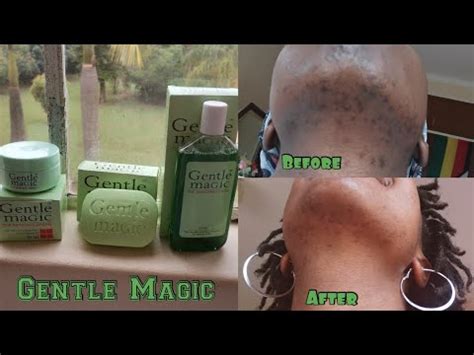 GENTLE MAGIC 4 WEEK TRIAL | SKIN CARE REVIEW - YouTube