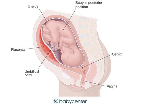 What's a sunny-side up baby? Your guide to the posterior position | BabyCenter