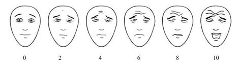 Faces Pain Scale Revised