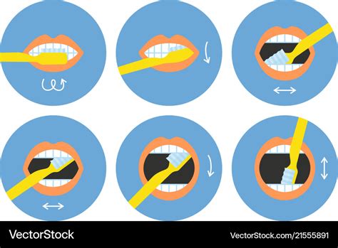 Kindergarten Steps To Brush Your Teeth - Teeth Poster