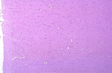 Cerebral Cortex Histology Layers