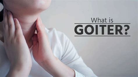 What is goiter? | what is goiter disease | what is goiter thyroid | what is goiter symptoms ...