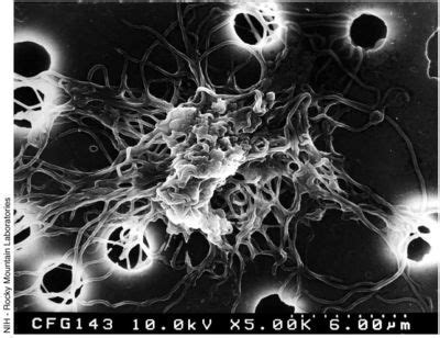 Borrelia - microbewiki