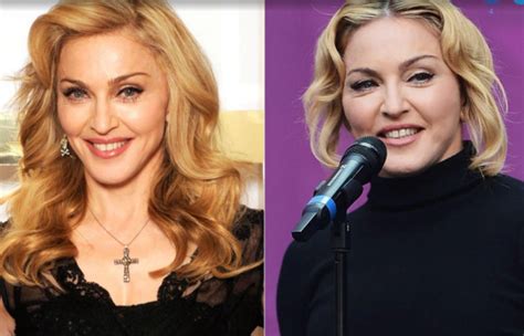 Madonna Plastic Surgery Before And After Face Photos