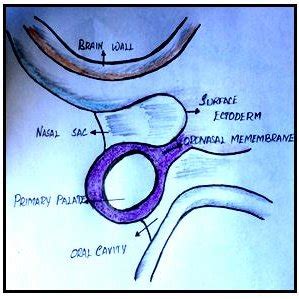 (PDF) “CHOANAL ATRESIA” EMBRYOLOGICAL BASIS AND ITS CLINICAL SIGNIFICANCE